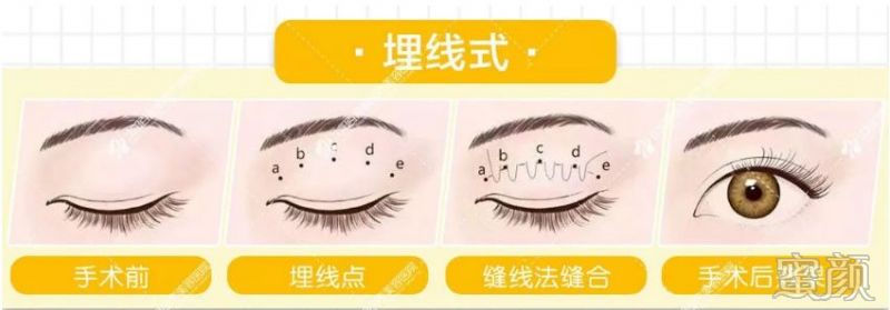 https://img.miyanlife.com/mnt/timg/200115/1F1353961-12.jpg