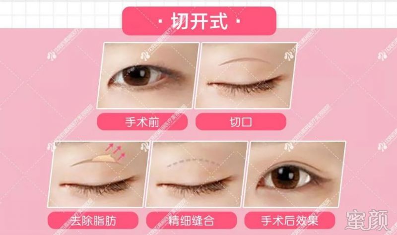https://img.miyanlife.com/mnt/timg/200115/1F13C440-14.jpg
