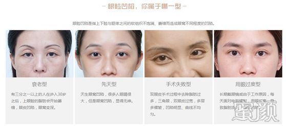https://img.miyanlife.com/mnt/timg/200115/1G52SX8-9.jpg