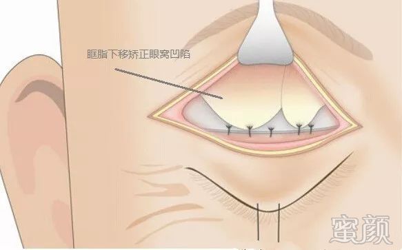https://img.miyanlife.com/mnt/timg/200115/1G52U411-10.jpg