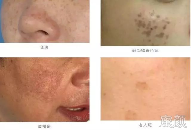 https://img.miyanlife.com/mnt/timg/200115/1HH43A1-1.jpg