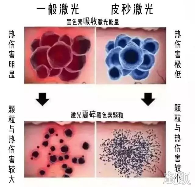 https://img.miyanlife.com/mnt/timg/200115/1HH95226-10.jpg