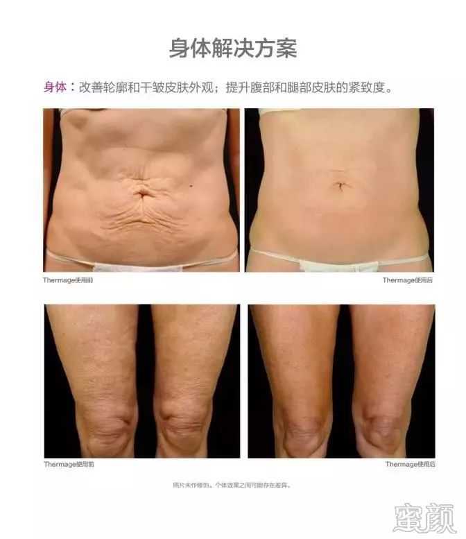 https://img.miyanlife.com/mnt/timg/200115/1J60I3b-15.jpg