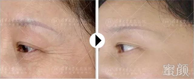 https://img.miyanlife.com/mnt/timg/200115/1R5353045-4.jpg