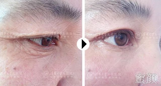 https://img.miyanlife.com/mnt/timg/200115/1R53LP5-9.jpg