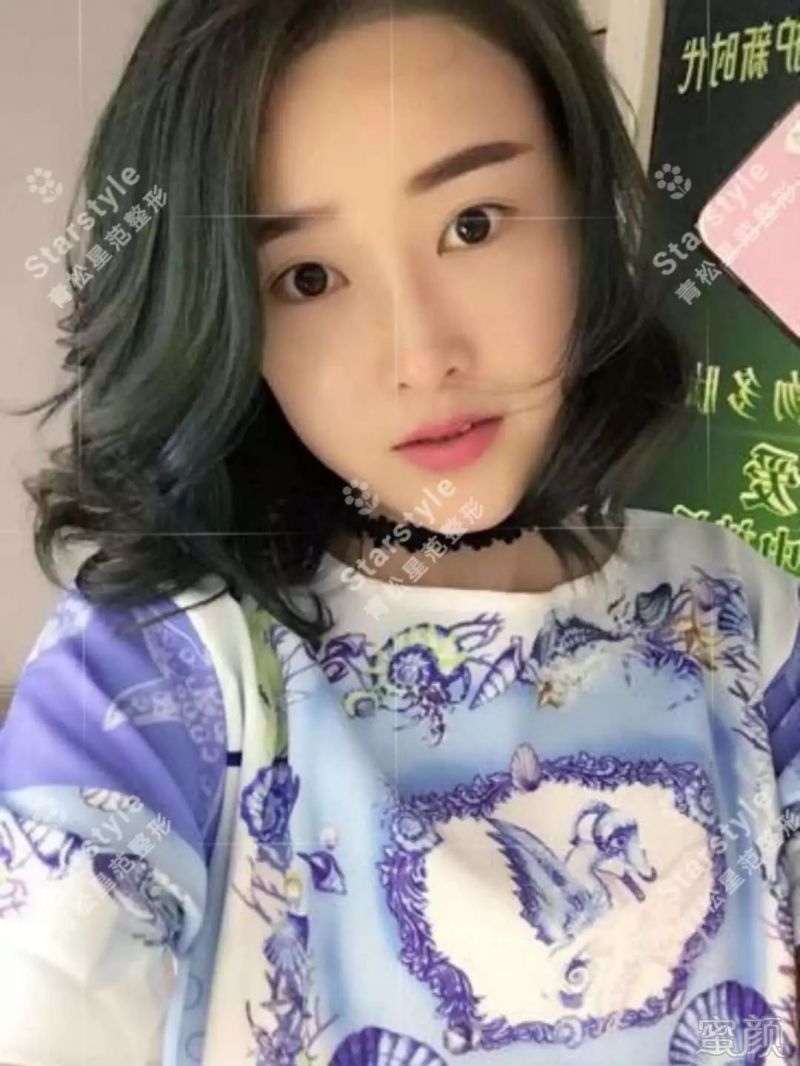 https://img.miyanlife.com/mnt/timg/200115/1U632D61-15.jpg