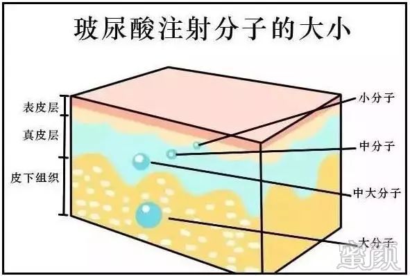 https://img.miyanlife.com/mnt/timg/200115/1U913JD-5.jpg