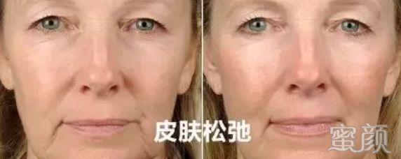 https://img.miyanlife.com/mnt/timg/200116/1151103Z0-2.jpg