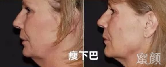 https://img.miyanlife.com/mnt/timg/200116/115111N35-3.jpg