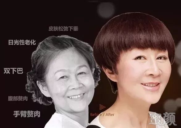 https://img.miyanlife.com/mnt/timg/200116/115113DU-7.jpg