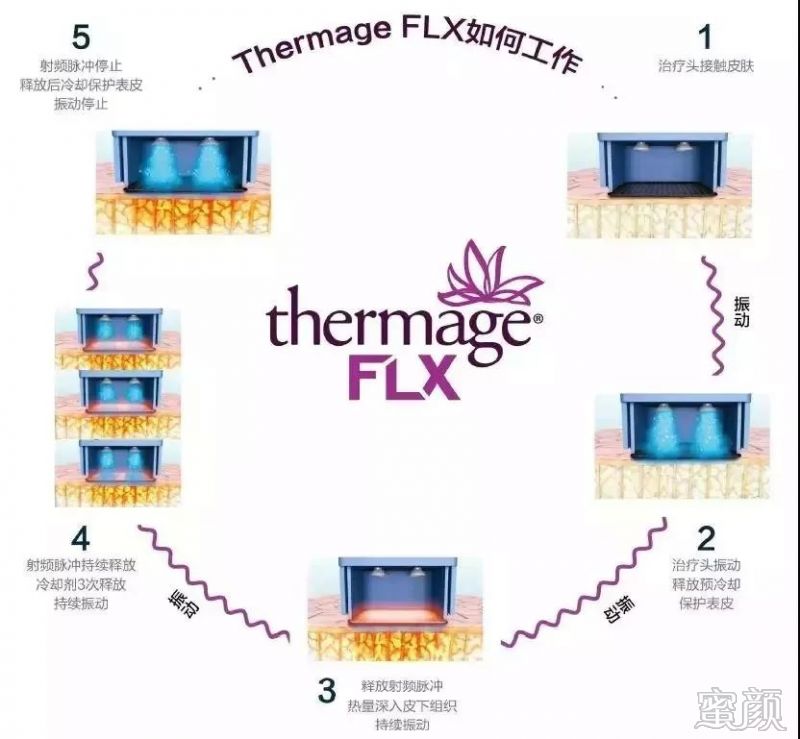 https://img.miyanlife.com/mnt/timg/200116/1155346312-3.jpg
