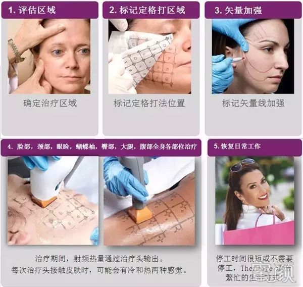 https://img.miyanlife.com/mnt/timg/200116/1403464548-9.jpg