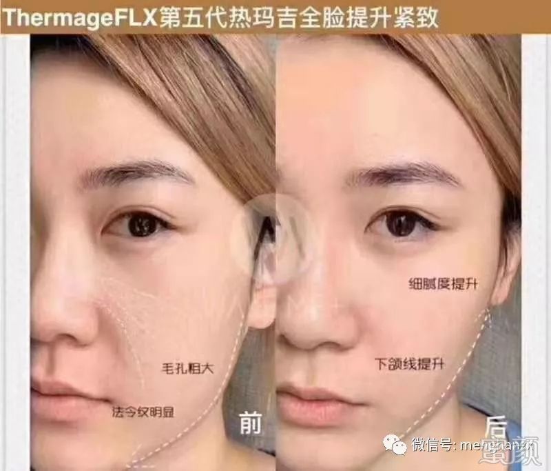 https://img.miyanlife.com/mnt/timg/200116/1406141512-1.jpg