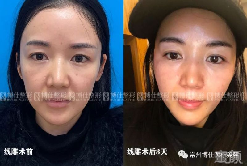 https://img.miyanlife.com/mnt/timg/200116/1420201933-0.jpg