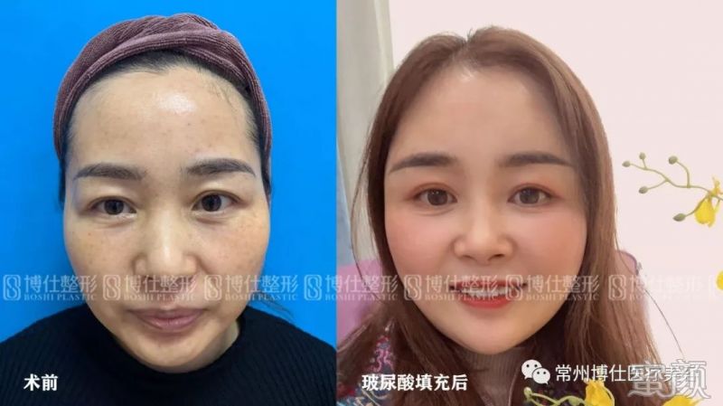 https://img.miyanlife.com/mnt/timg/200116/1420224245-2.jpg