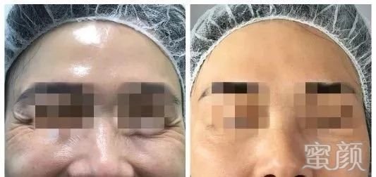 https://img.miyanlife.com/mnt/timg/200117/1211501M0-7.jpg