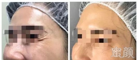https://img.miyanlife.com/mnt/timg/200117/1211514164-8.jpg
