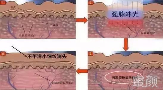 案例图片