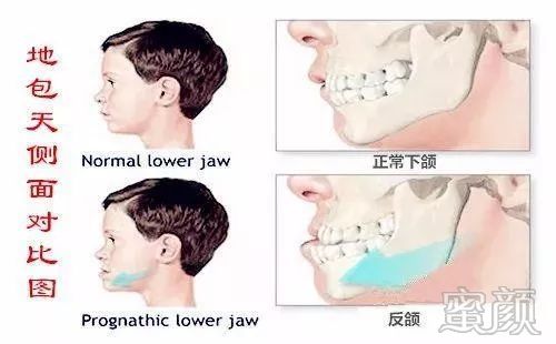 案例图片