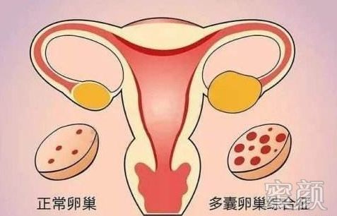 https://img.miyanlife.com/mnt/timg/200118/13405H531-1.jpg