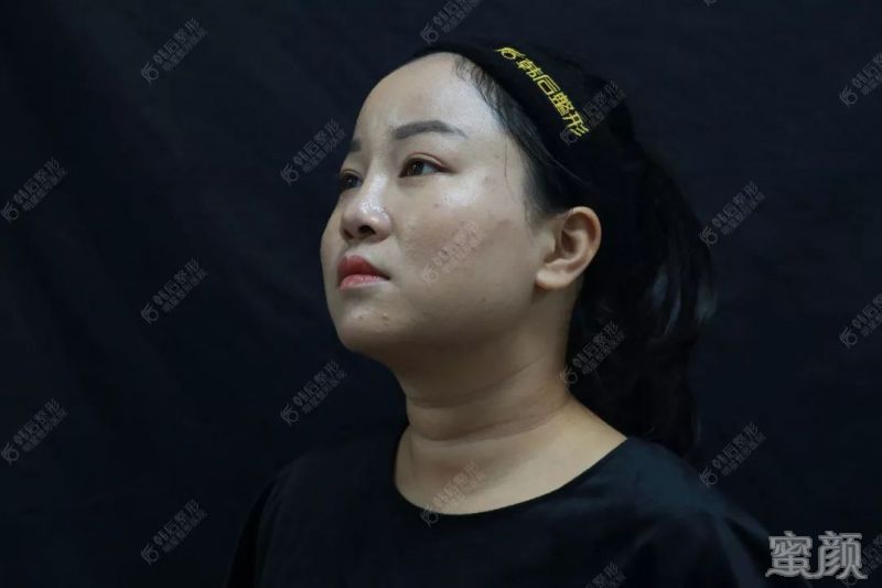 https://img.miyanlife.com/mnt/timg/200118/1556394E7-6.jpg