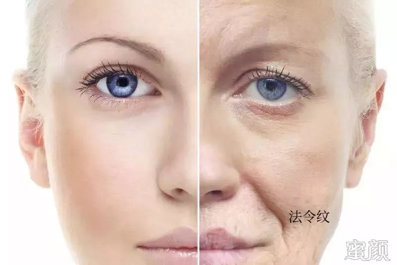 https://img.miyanlife.com/mnt/timg/200118/15563KA0-3.jpg