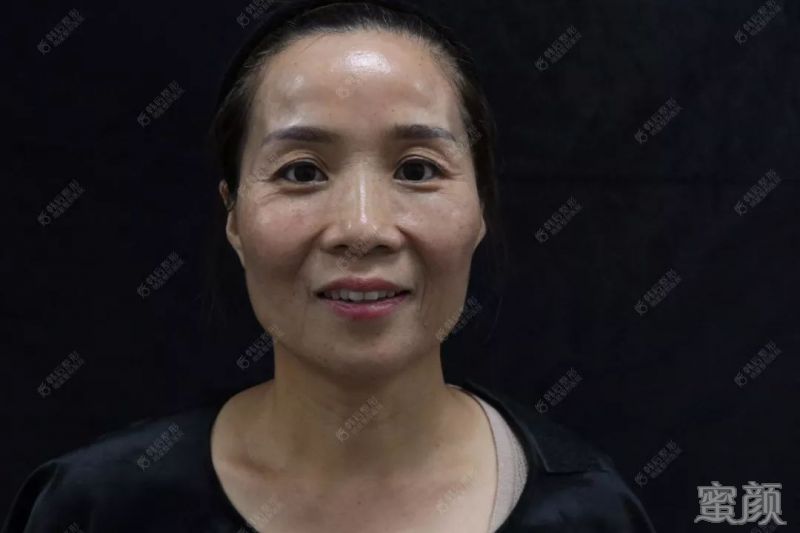 https://img.miyanlife.com/mnt/timg/200118/155641LN-10.jpg