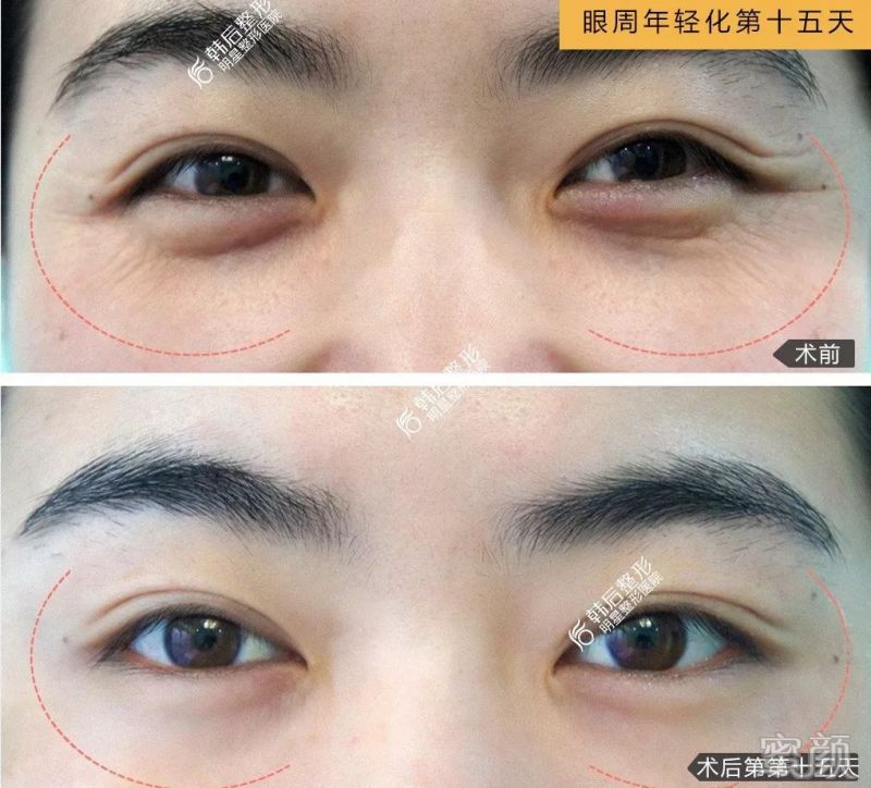 https://img.miyanlife.com/mnt/timg/200118/1556424492-12.jpg