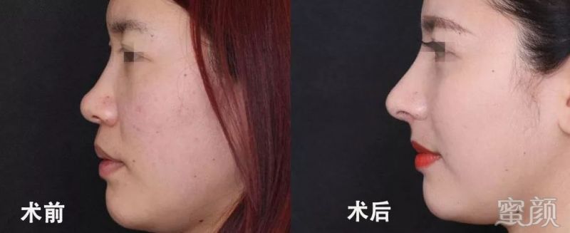https://img.miyanlife.com/mnt/timg/200119/133T3M05-3.jpg