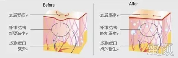 https://img.miyanlife.com/mnt/timg/200119/133T3O01-2.jpg