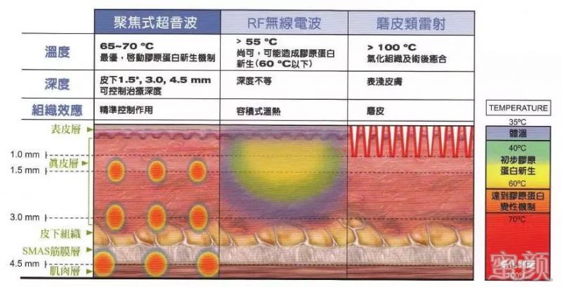 案例图片