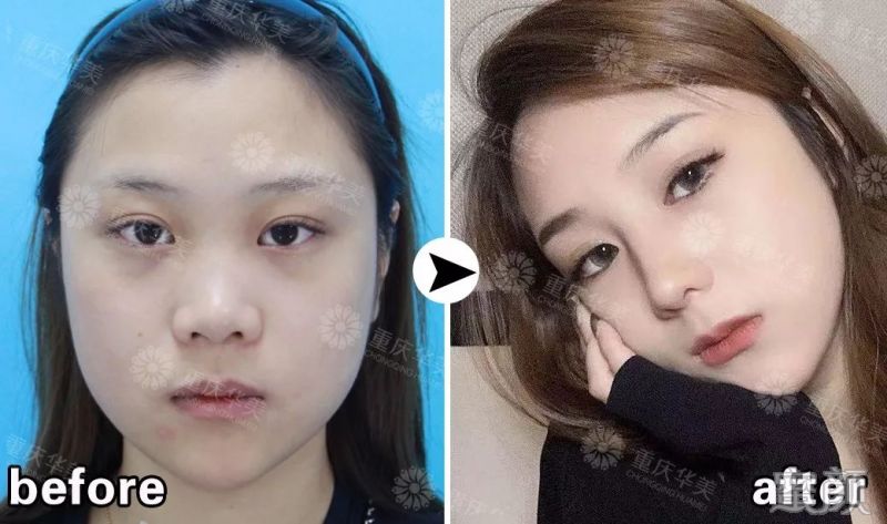 https://img.miyanlife.com/mnt/timg/200120/1325161X7-19.jpg