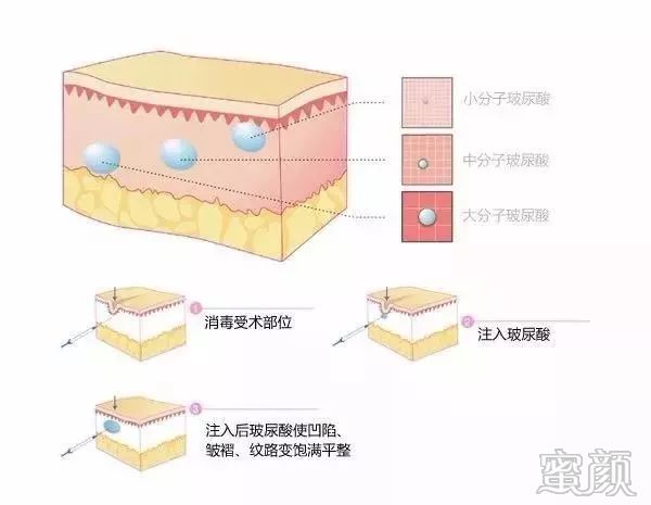 https://img.miyanlife.com/mnt/timg/200120/13412AR9-4.jpg