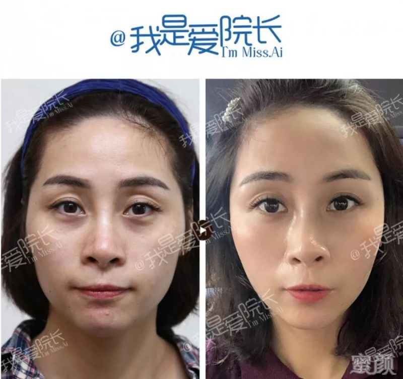 https://img.miyanlife.com/mnt/timg/200121/1225436421-0.jpg