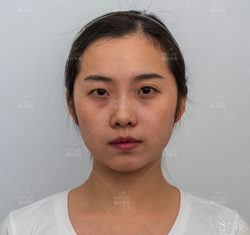 https://img.miyanlife.com/mnt/timg/200131/1311242092-2.jpg