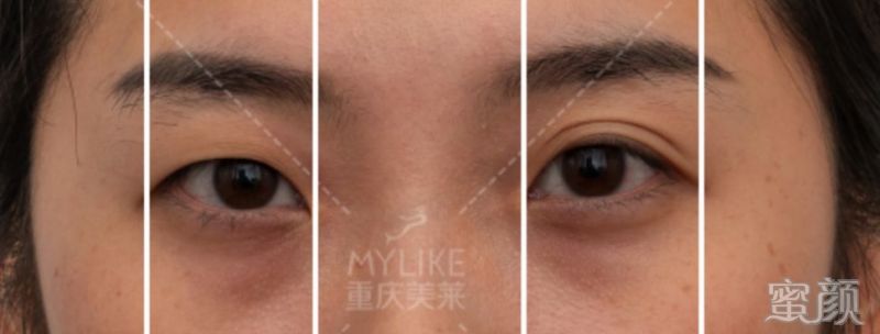 https://img.miyanlife.com/mnt/timg/200131/13112423U-3.jpg