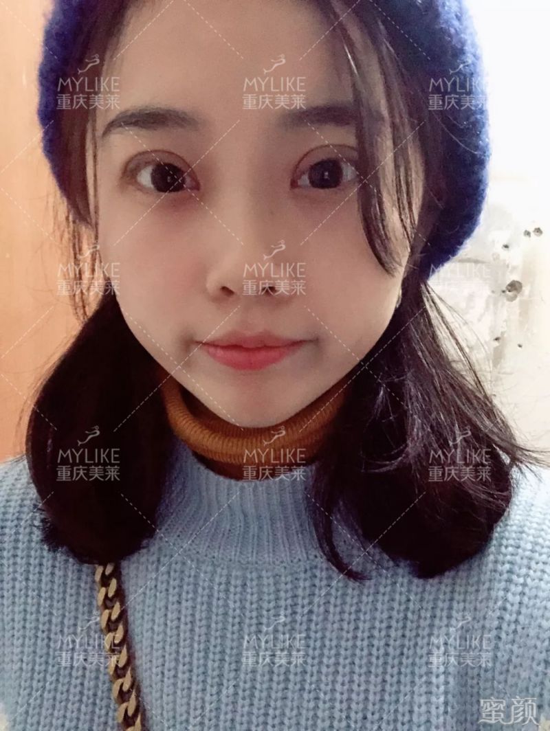 https://img.miyanlife.com/mnt/timg/200131/1311261K7-5.jpg