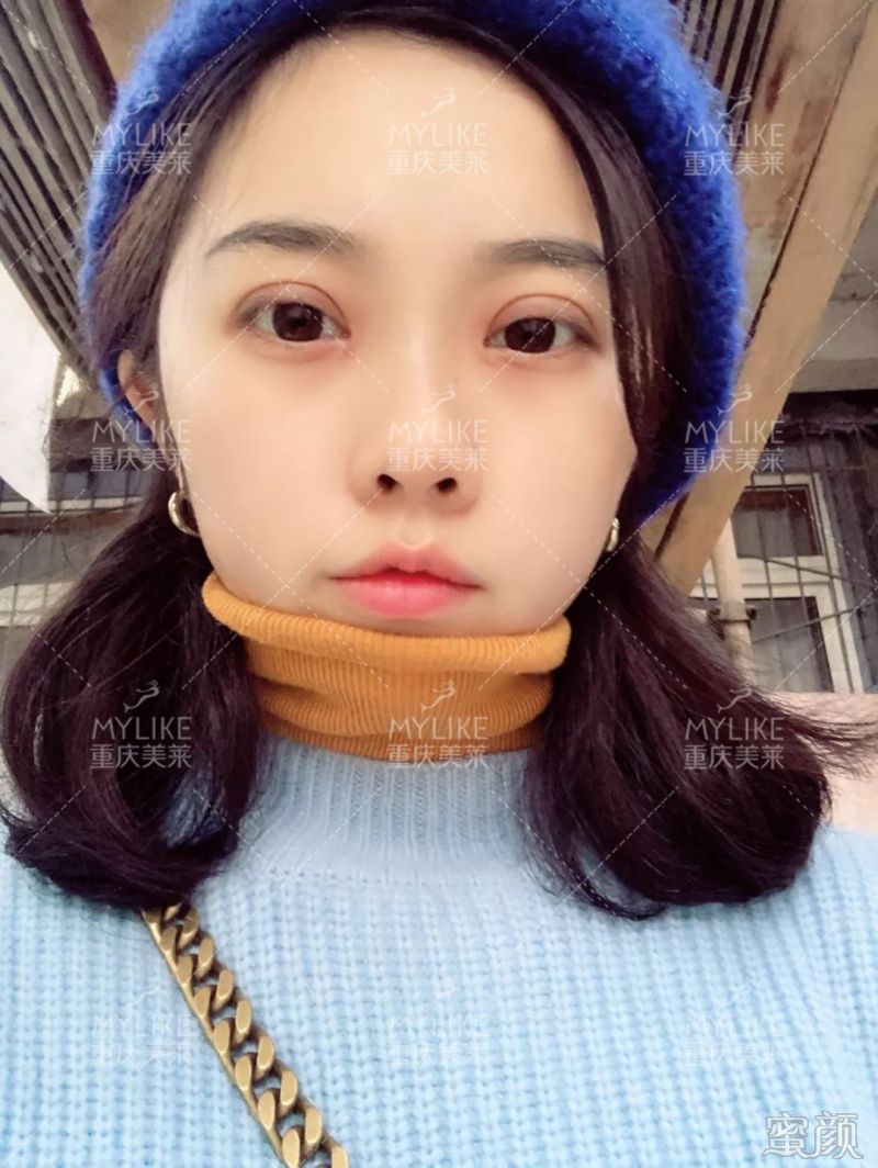 https://img.miyanlife.com/mnt/timg/200131/13112KO4-6.jpg