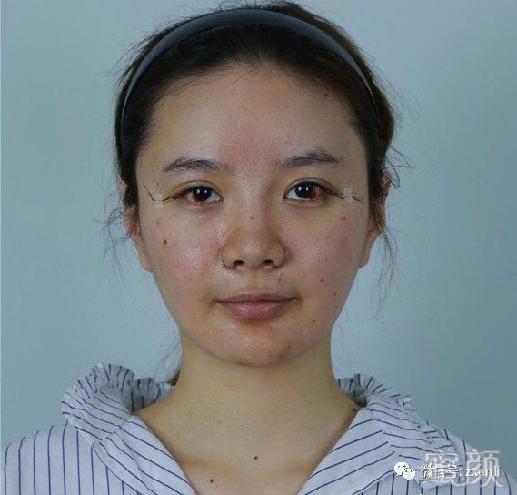 https://img.miyanlife.com/mnt/timg/200131/1311361939-0.jpg
