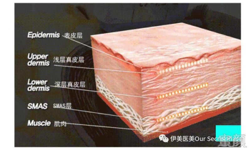 https://img.miyanlife.com/mnt/timg/200205/13463522G-1.jpg