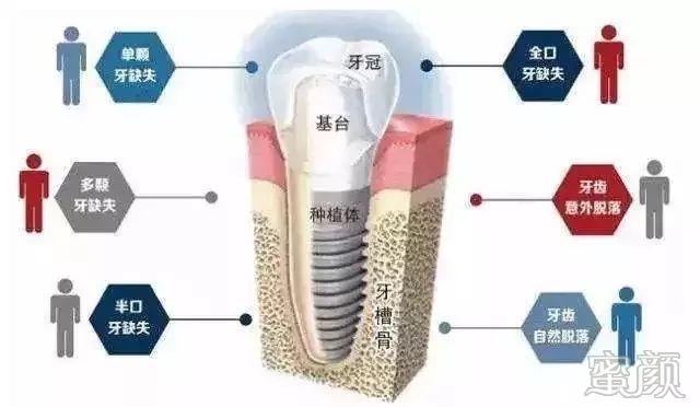 案例图片