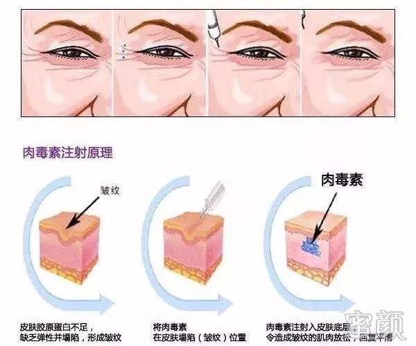 https://img.miyanlife.com/mnt/timg/200207/13443340F-2.jpg