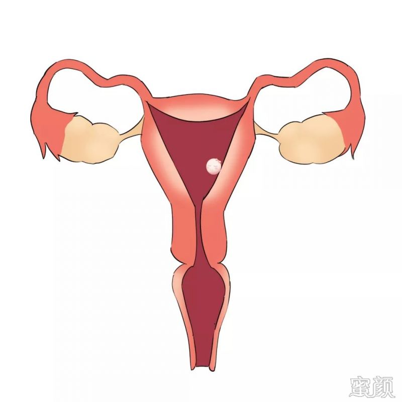 https://img.miyanlife.com/mnt/timg/200207/13593T2C-0.jpg