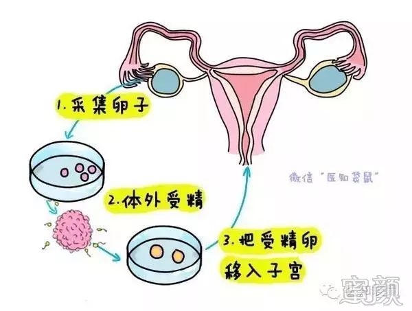 https://img.miyanlife.com/mnt/timg/200207/135U25616-1.jpg