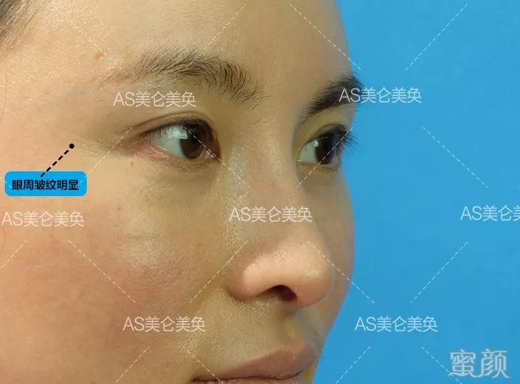https://img.miyanlife.com/mnt/timg/200208/13460V218-6.jpg