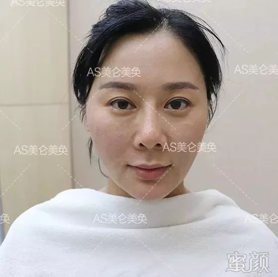 https://img.miyanlife.com/mnt/timg/200208/1346124317-13.jpg