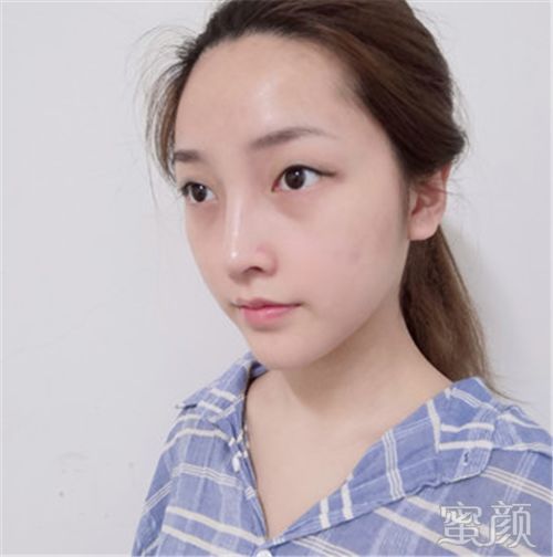 https://img.miyanlife.com/mnt/timg/200208/1356262K1-0.jpg