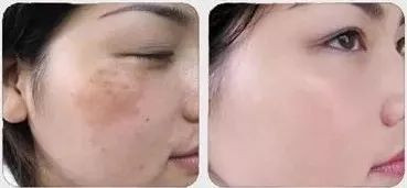 https://img.miyanlife.com/mnt/timg/200208/1411032321-3.jpg