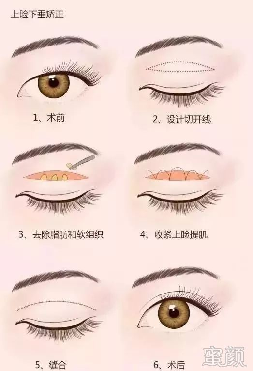 https://img.miyanlife.com/mnt/timg/200208/1421194254-7.jpg