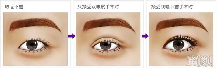 https://img.miyanlife.com/mnt/timg/200208/14211VR3-6.jpg